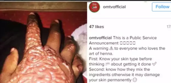 Na Wa Oh! See What Happened To Woman’s Hand After Getting Henna Tattoo